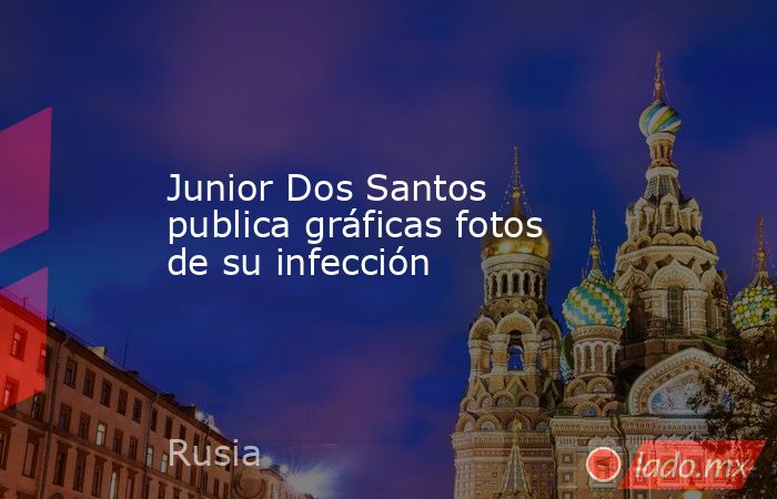 Junior Dos Santos publica gráficas fotos de su infección. Noticias en tiempo real