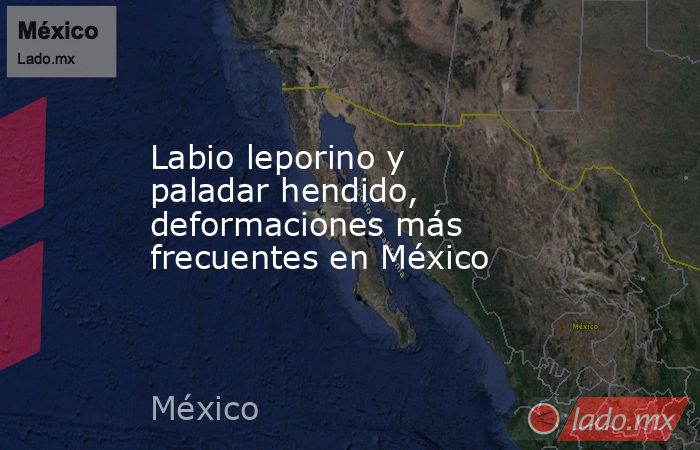 Labio leporino y paladar hendido, deformaciones más frecuentes en México. Noticias en tiempo real