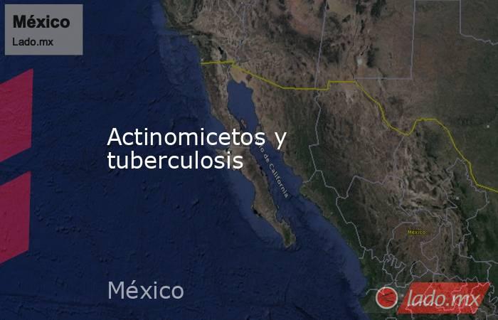 Actinomicetos y tuberculosis. Noticias en tiempo real