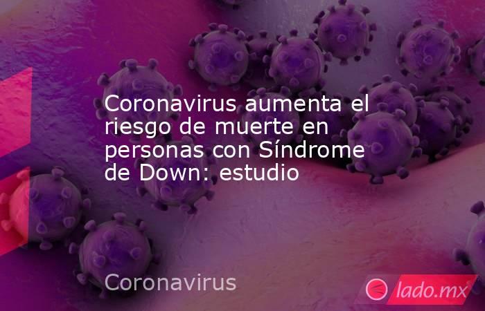 Coronavirus aumenta el riesgo de muerte en personas con Síndrome de Down: estudio 
. Noticias en tiempo real