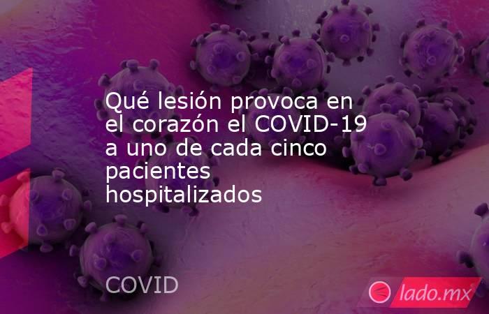 Qué lesión provoca en el corazón el COVID-19 a uno de cada cinco pacientes hospitalizados. Noticias en tiempo real