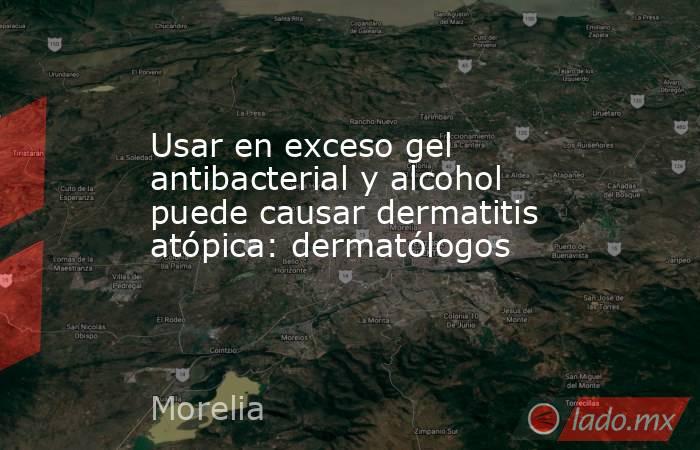 Usar en exceso gel antibacterial y alcohol puede causar dermatitis atópica: dermatólogos. Noticias en tiempo real