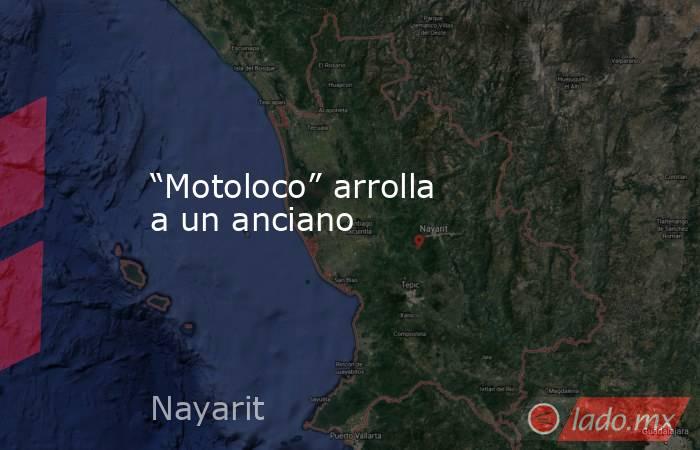 “Motoloco” arrolla a un anciano. Noticias en tiempo real