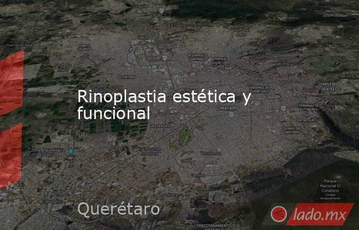 Rinoplastia estética y funcional. Noticias en tiempo real