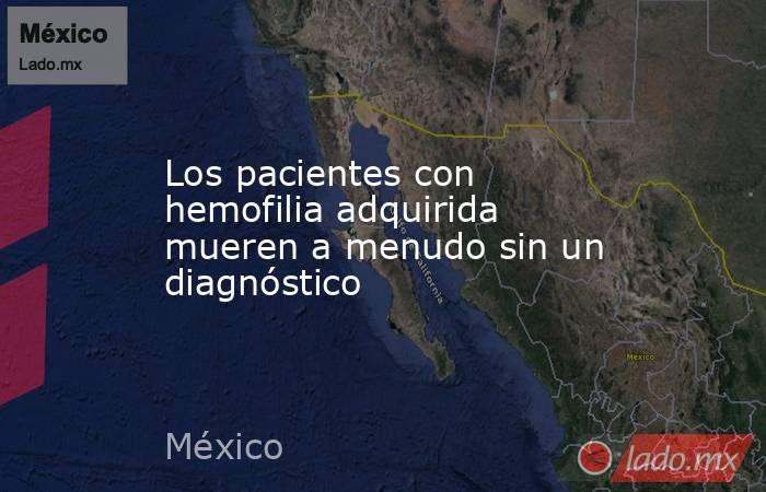 Los pacientes con hemofilia adquirida mueren a menudo sin un diagnóstico. Noticias en tiempo real