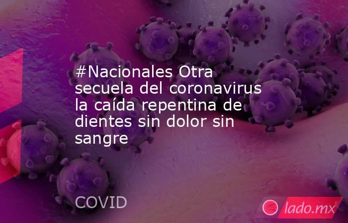 #Nacionales Otra secuela del coronavirus la caída repentina de dientes sin dolor sin sangre. Noticias en tiempo real