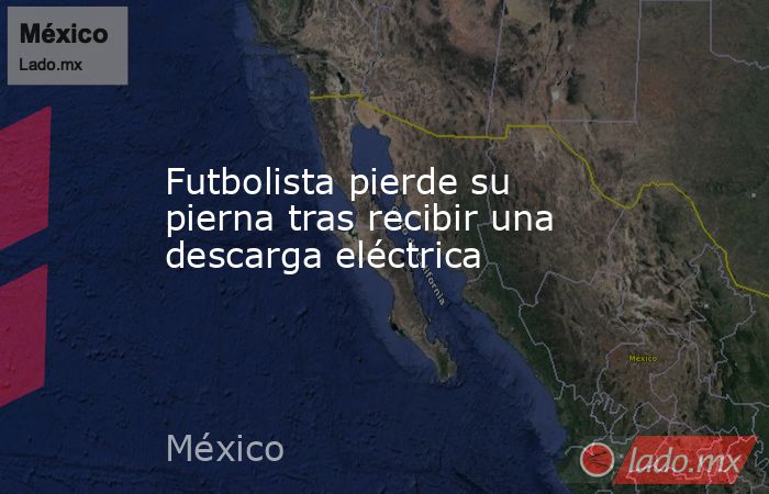 Futbolista pierde su pierna tras recibir una descarga eléctrica. Noticias en tiempo real