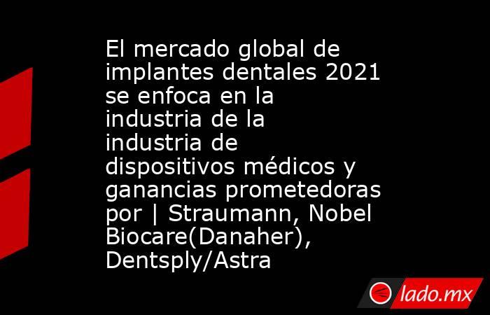 El mercado global de implantes dentales 2021 se enfoca en la industria de la industria de dispositivos médicos y ganancias prometedoras por | Straumann, Nobel Biocare(Danaher), Dentsply/Astra. Noticias en tiempo real