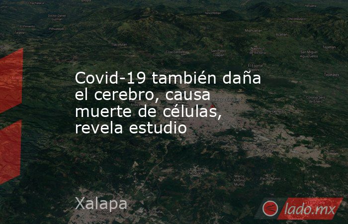 Covid-19 también daña el cerebro, causa muerte de células, revela estudio. Noticias en tiempo real