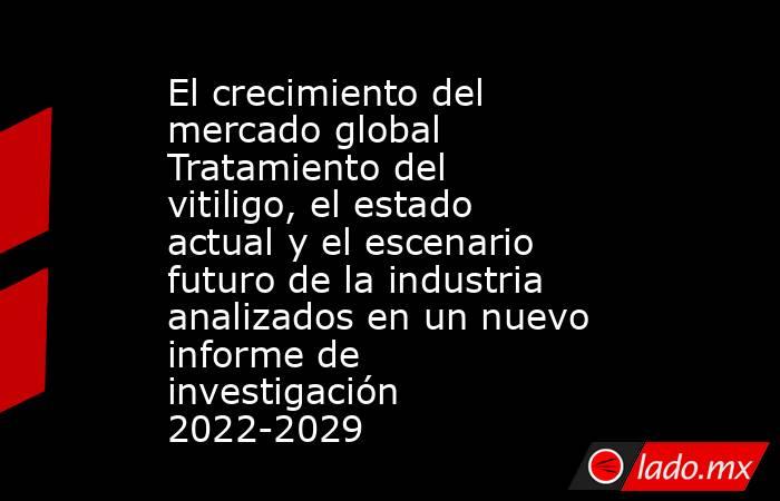 El crecimiento del mercado global Tratamiento del vitiligo, el estado actual y el escenario futuro de la industria analizados en un nuevo informe de investigación 2022-2029. Noticias en tiempo real