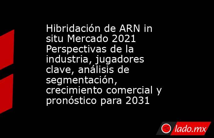 Hibridación de ARN in situ Mercado 2021 Perspectivas de la industria, jugadores clave, análisis de segmentación, crecimiento comercial y pronóstico para 2031. Noticias en tiempo real