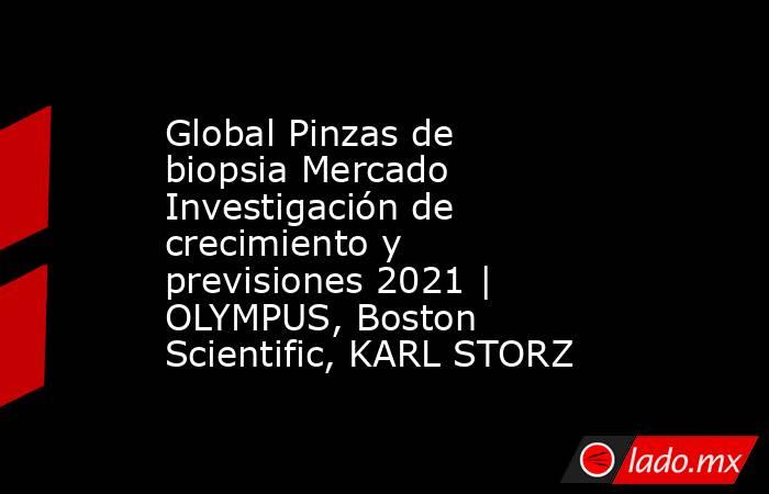 Global Pinzas de biopsia Mercado Investigación de crecimiento y previsiones 2021 | OLYMPUS, Boston Scientific, KARL STORZ. Noticias en tiempo real