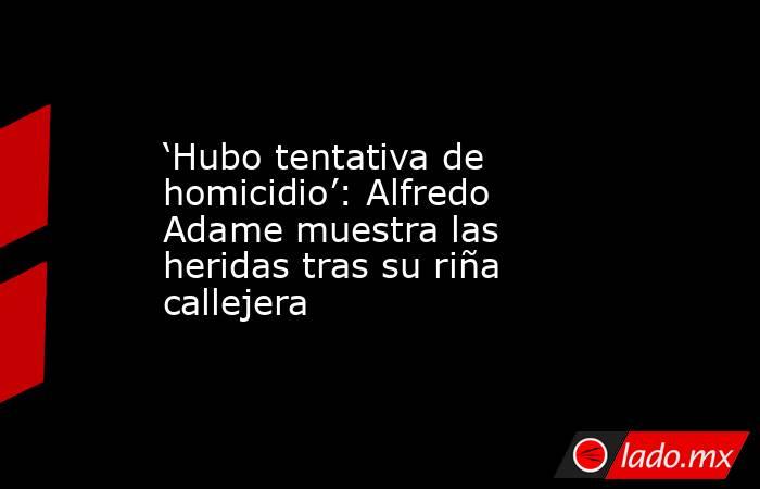 ‘Hubo tentativa de homicidio’: Alfredo Adame muestra las heridas tras su riña callejera. Noticias en tiempo real